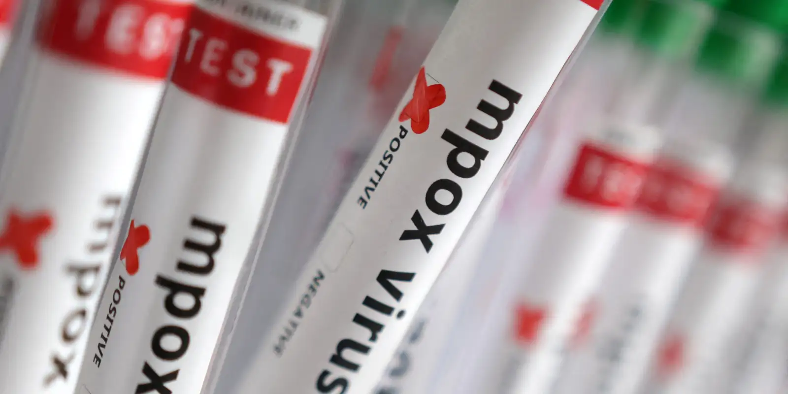 Sobe para 140 número de casos confirmados de Mpox no país, em 2026